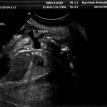 Brandy's ultrasound #2